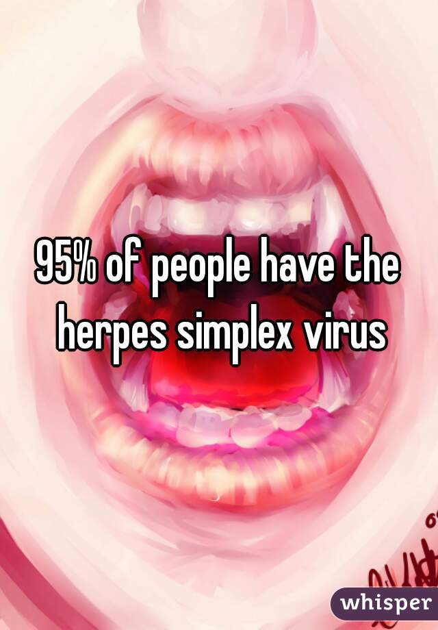 95% of people have the herpes simplex virus