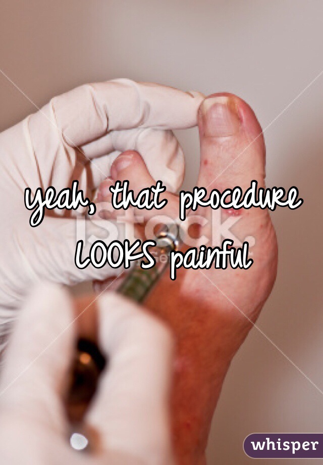 yeah, that procedure LOOKS painful 