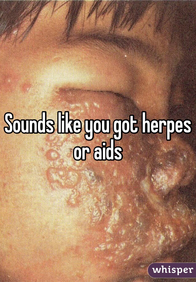 Sounds like you got herpes or aids