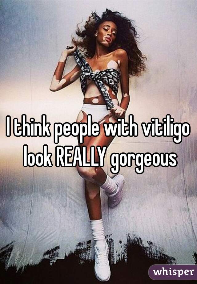 I think people with vitiligo look REALLY gorgeous