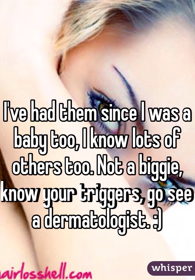 I've had them since I was a baby too, I know lots of others too. Not a biggie, know your triggers, go see a dermatologist. :)