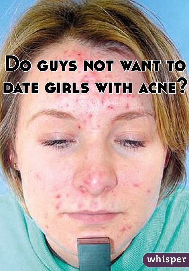 Do guys not want to date girls with acne?