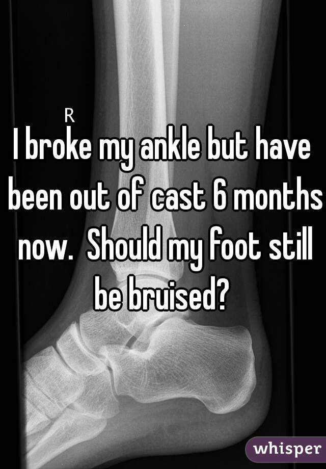 I broke my ankle but have been out of cast 6 months now.  Should my foot still be bruised? 