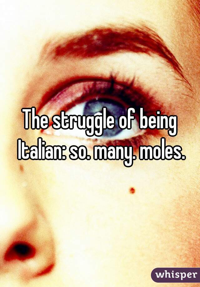 The struggle of being Italian: so. many. moles.