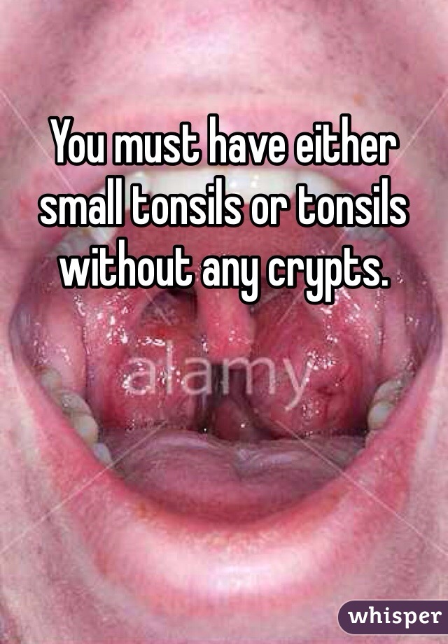 You must have either small tonsils or tonsils without any crypts.