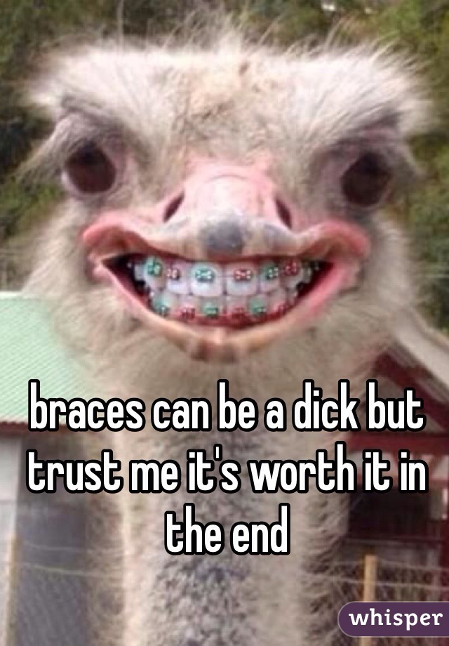 braces can be a dick but trust me it's worth it in the end