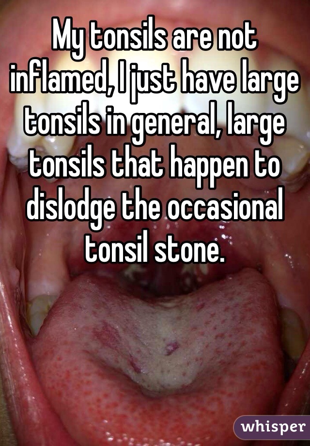 My tonsils are not inflamed, I just have large tonsils in general, large tonsils that happen to dislodge the occasional tonsil stone. 