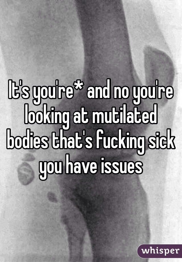 It's you're* and no you're looking at mutilated bodies that's fucking sick you have issues 