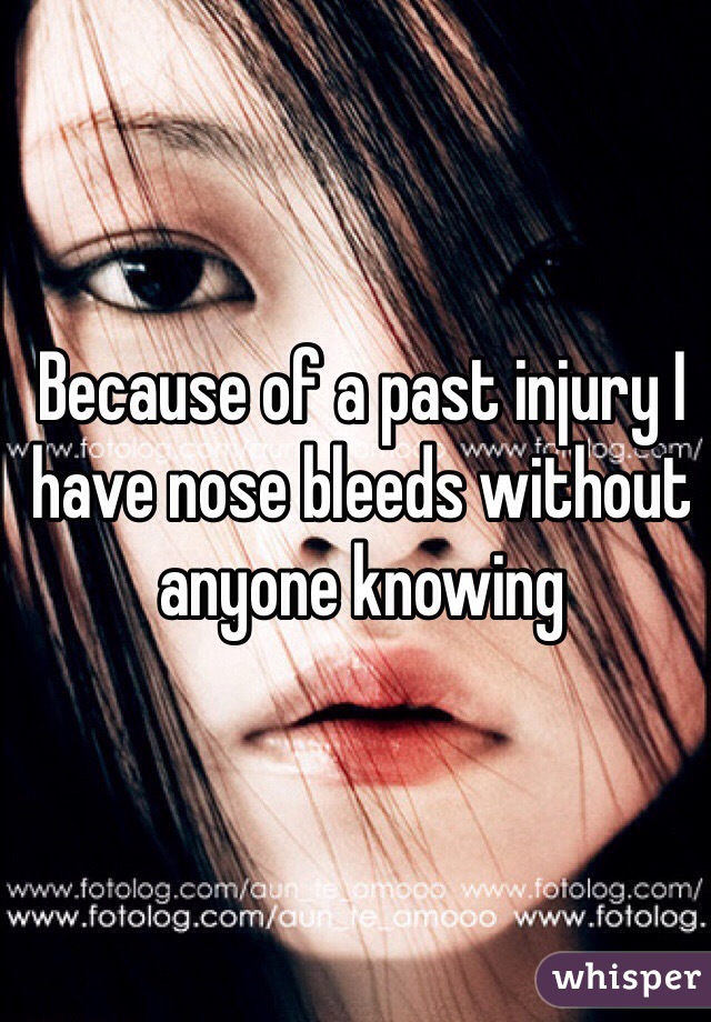 Because of a past injury I have nose bleeds without anyone knowing 