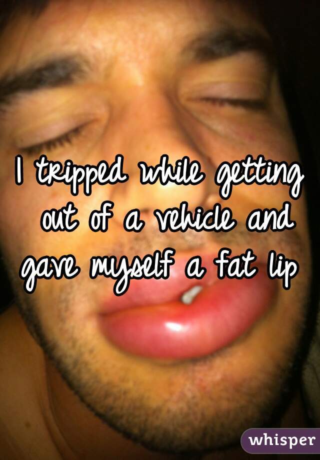 I tripped while getting out of a vehicle and gave myself a fat lip 