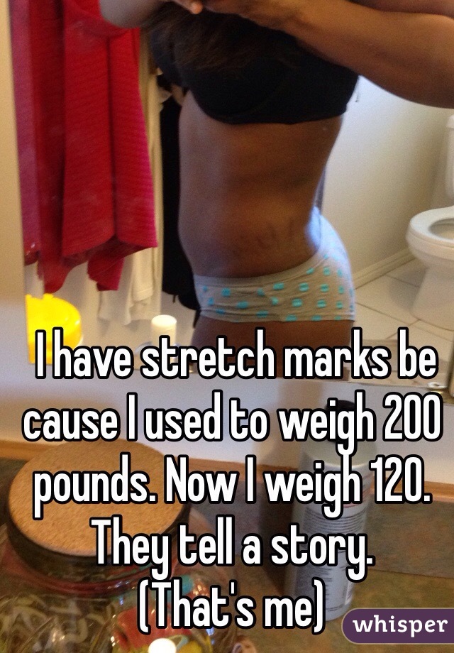  I have stretch marks be cause I used to weigh 200 pounds. Now I weigh 120. They tell a story. 
(That's me)