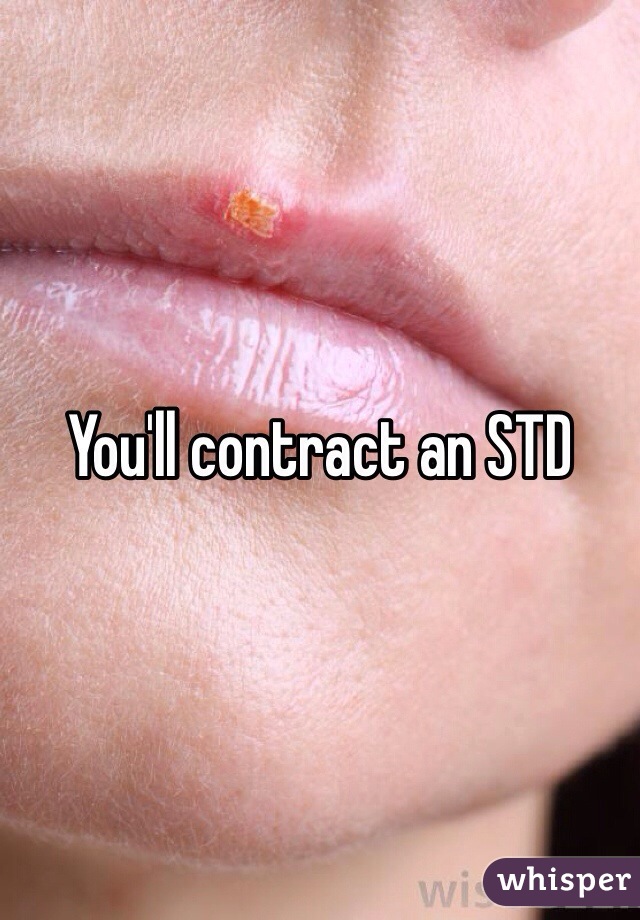You'll contract an STD