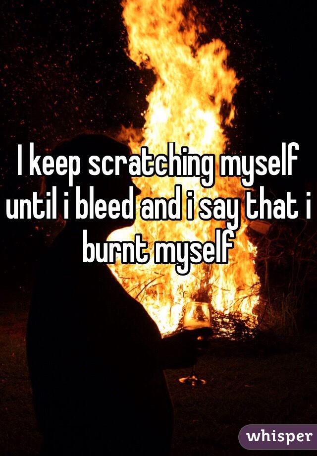I keep scratching myself until i bleed and i say that i burnt myself 
