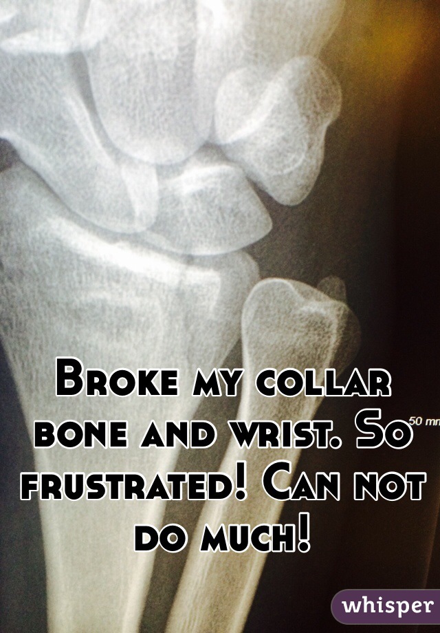 Broke my collar bone and wrist. So frustrated! Can not do much! 