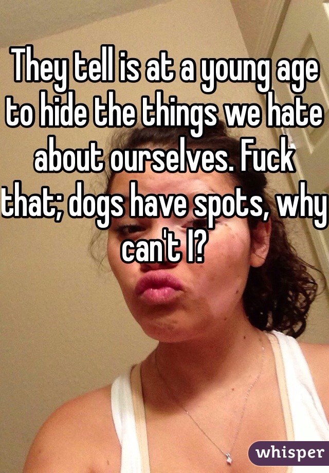 They tell is at a young age to hide the things we hate about ourselves. Fuck that; dogs have spots, why can't I? 