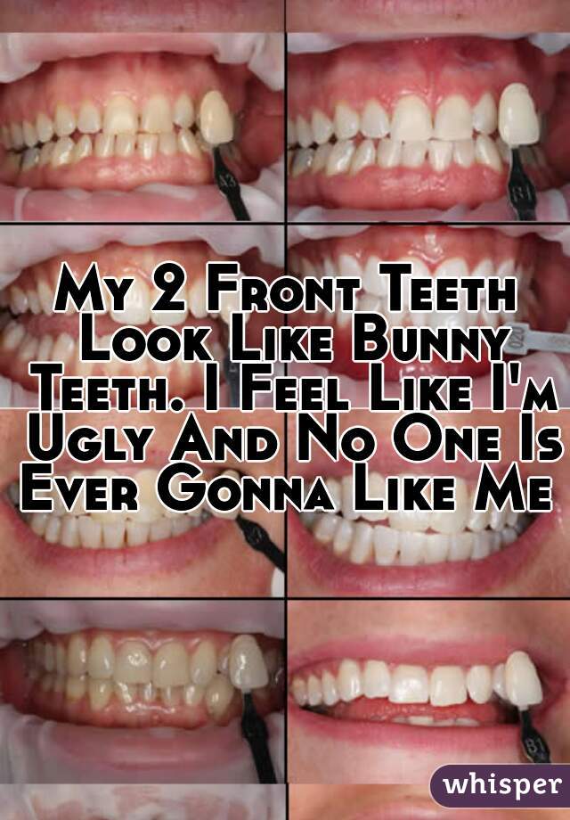My 2 Front Teeth Look Like Bunny Teeth. I Feel Like I'm Ugly And No One Is Ever Gonna Like Me 