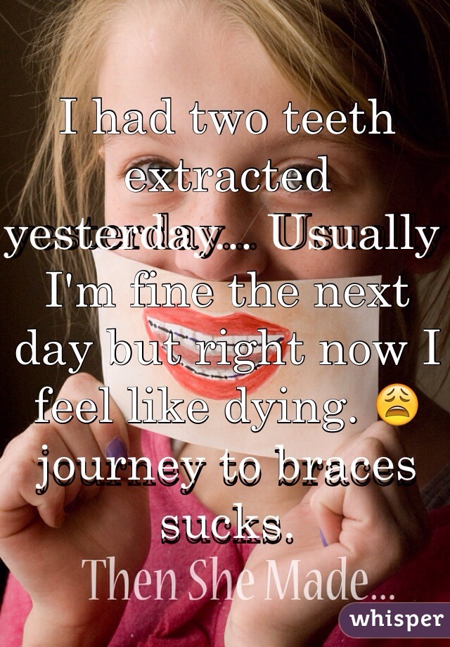 I had two teeth extracted yesterday... Usually I'm fine the next day but right now I feel like dying. 😩 journey to braces sucks. 