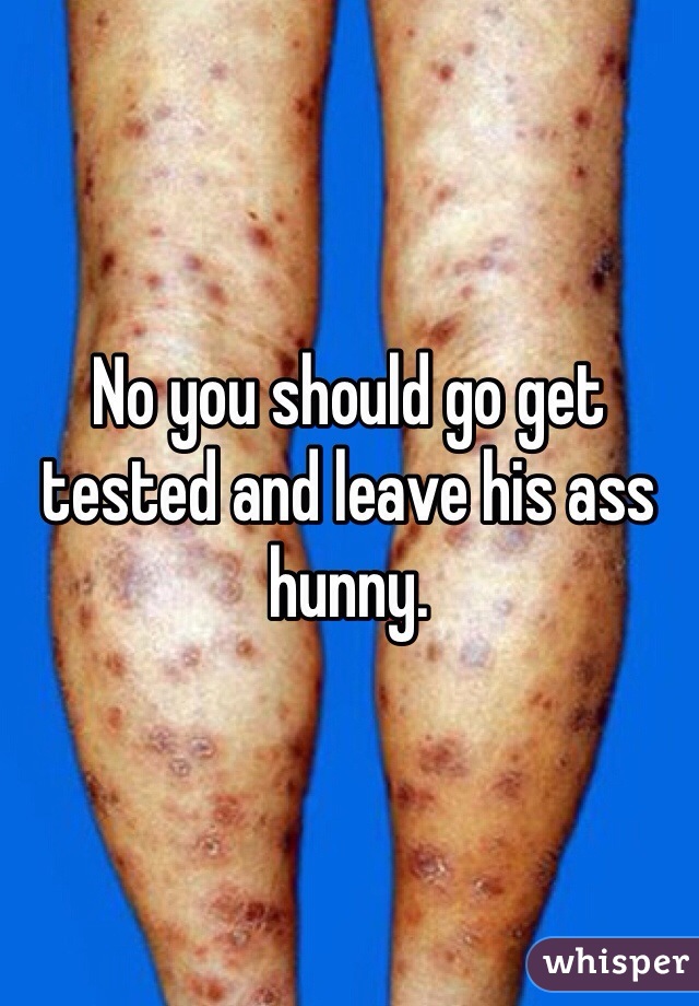 No you should go get tested and leave his ass hunny. 