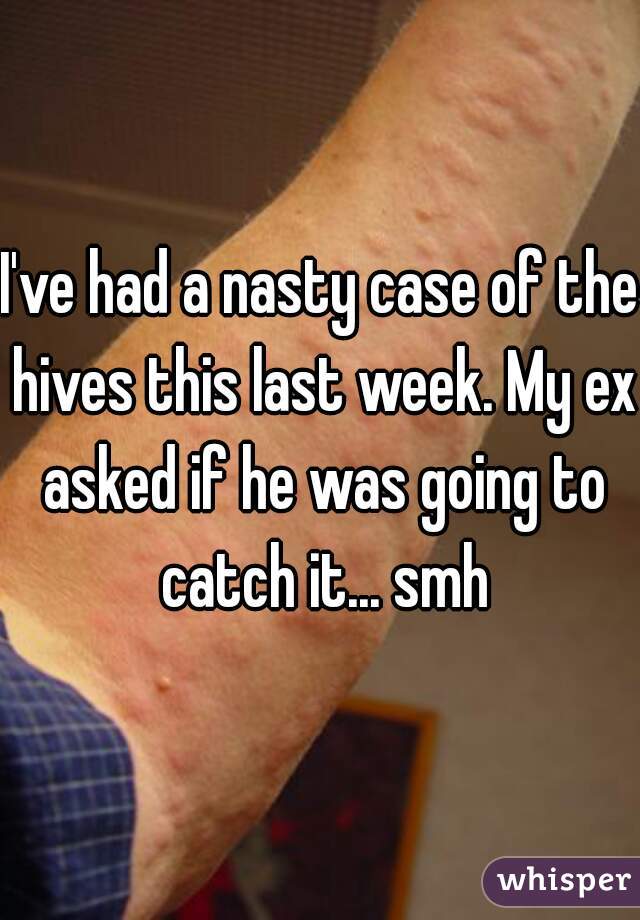 I've had a nasty case of the hives this last week. My ex asked if he was going to catch it... smh