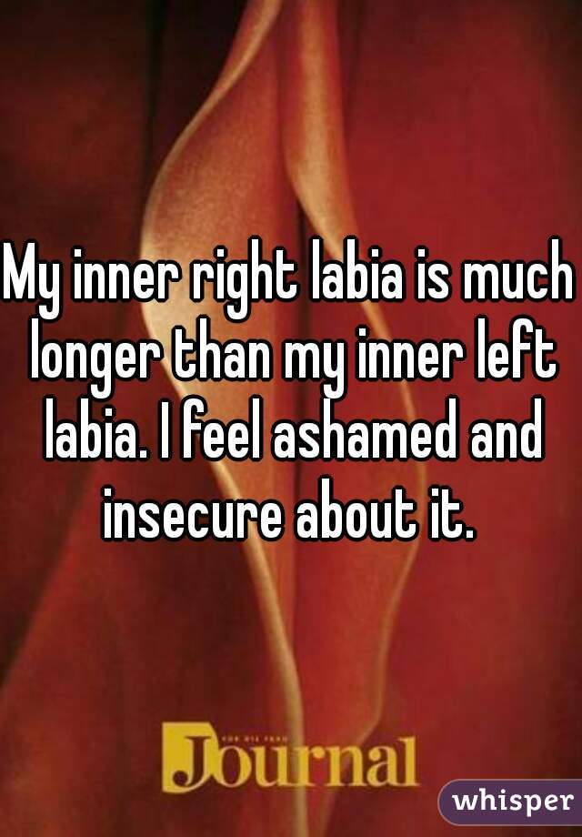 My inner right labia is much longer than my inner left labia. I feel ashamed and insecure about it. 