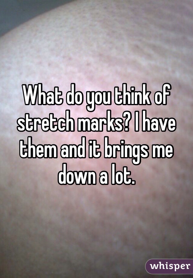 What do you think of stretch marks? I have them and it brings me down a lot. 