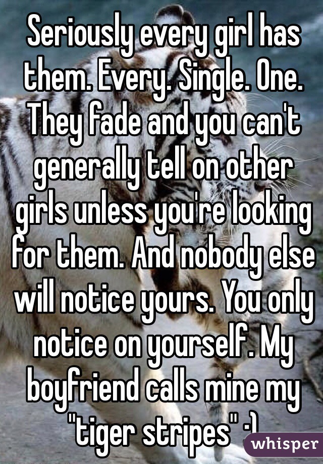 Seriously every girl has them. Every. Single. One. They fade and you can't generally tell on other girls unless you're looking for them. And nobody else will notice yours. You only notice on yourself. My boyfriend calls mine my "tiger stripes" :)