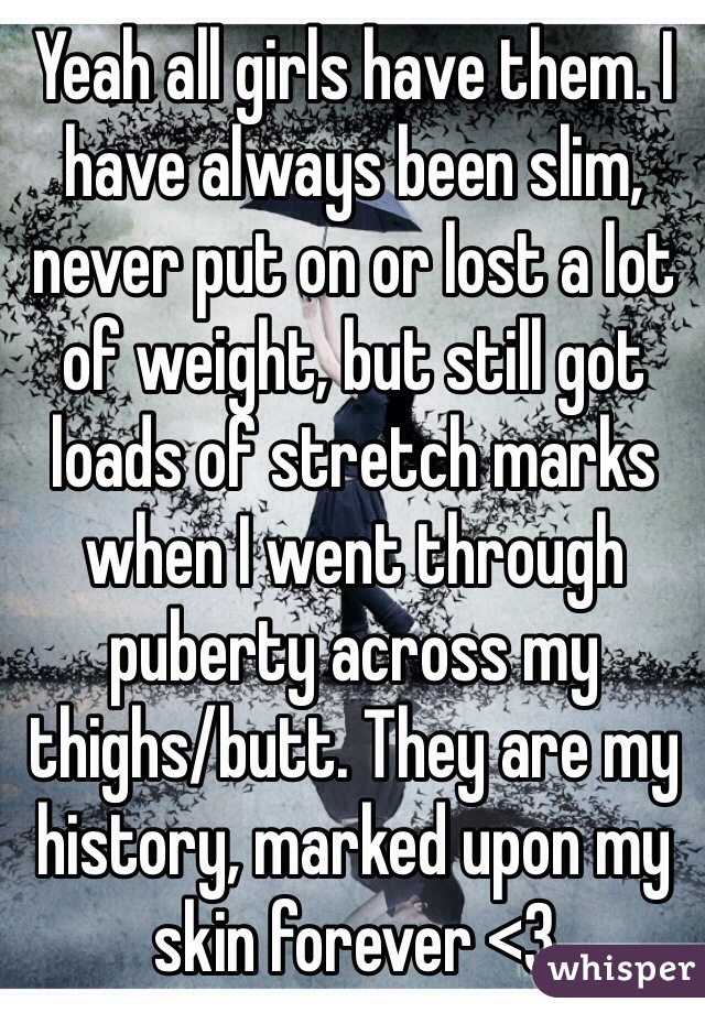 Yeah all girls have them. I have always been slim, never put on or lost a lot of weight, but still got loads of stretch marks when I went through puberty across my thighs/butt. They are my history, marked upon my skin forever <3