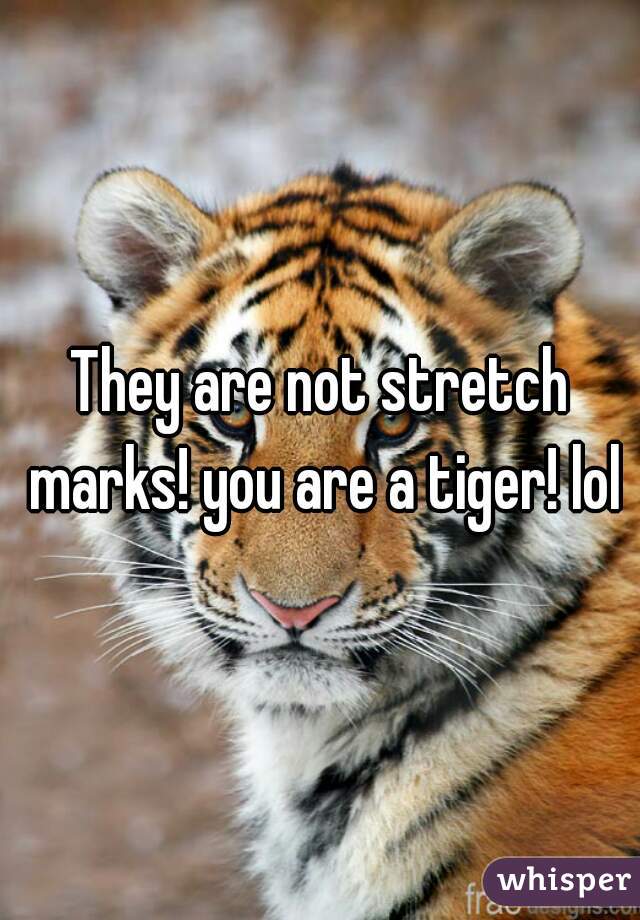 They are not stretch marks! you are a tiger! lol