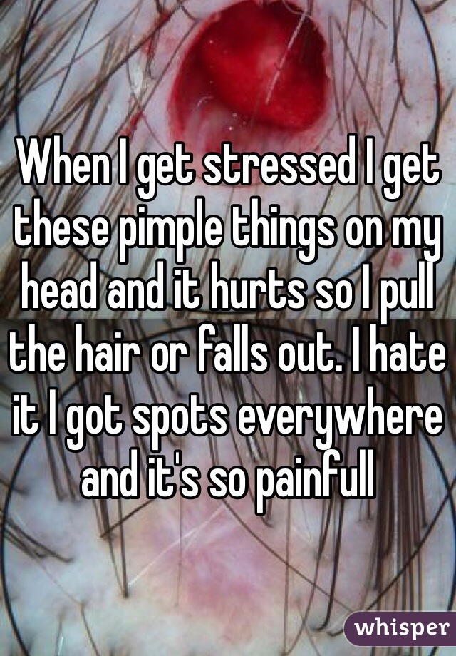 When I get stressed I get these pimple things on my head and it hurts so I pull the hair or falls out. I hate it I got spots everywhere and it's so painfull