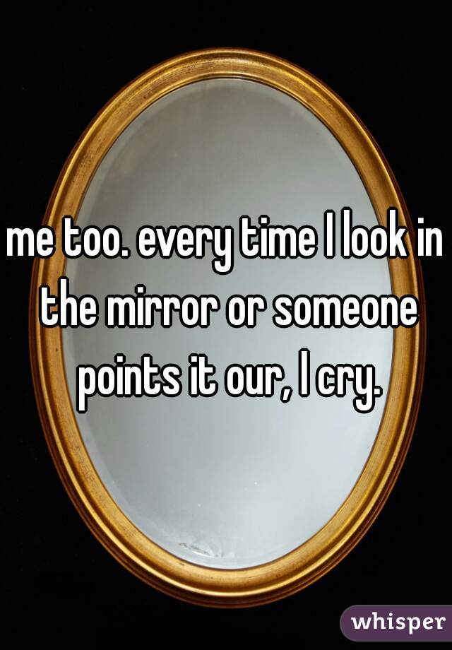 me too. every time I look in the mirror or someone points it our, I cry.