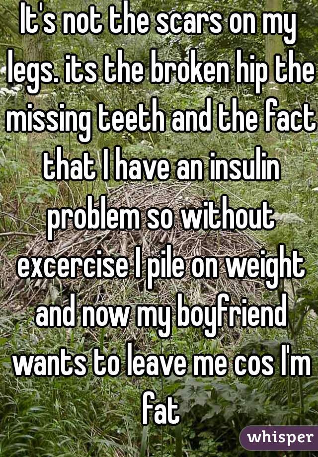 It's not the scars on my legs. its the broken hip the missing teeth and the fact that I have an insulin problem so without excercise I pile on weight and now my boyfriend wants to leave me cos I'm fat
