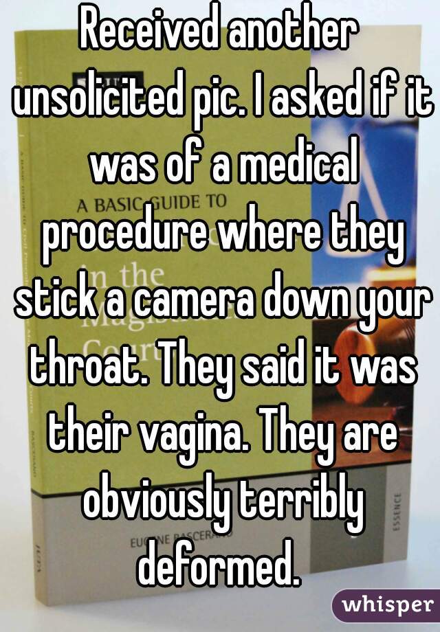 Received another unsolicited pic. I asked if it was of a medical procedure where they stick a camera down your throat. They said it was their vagina. They are obviously terribly deformed. 