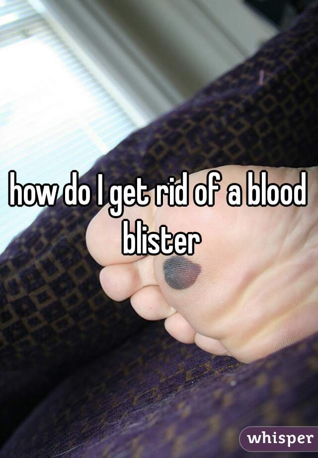 how do I get rid of a blood blister