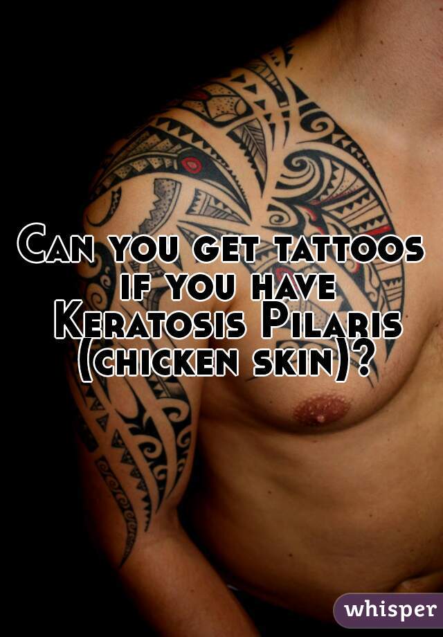 Can you get tattoos if you have Keratosis Pilaris (chicken skin)?
