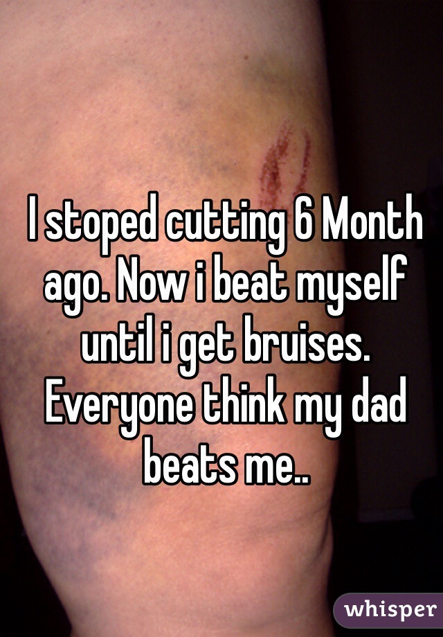 I stoped cutting 6 Month ago. Now i beat myself until i get bruises. Everyone think my dad beats me.. 