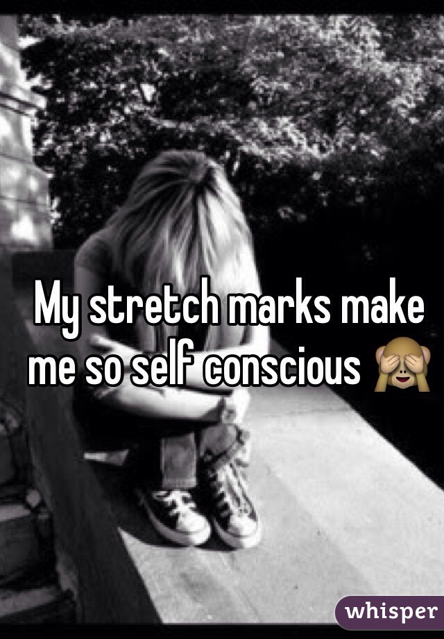 My stretch marks make me so self conscious 🙈