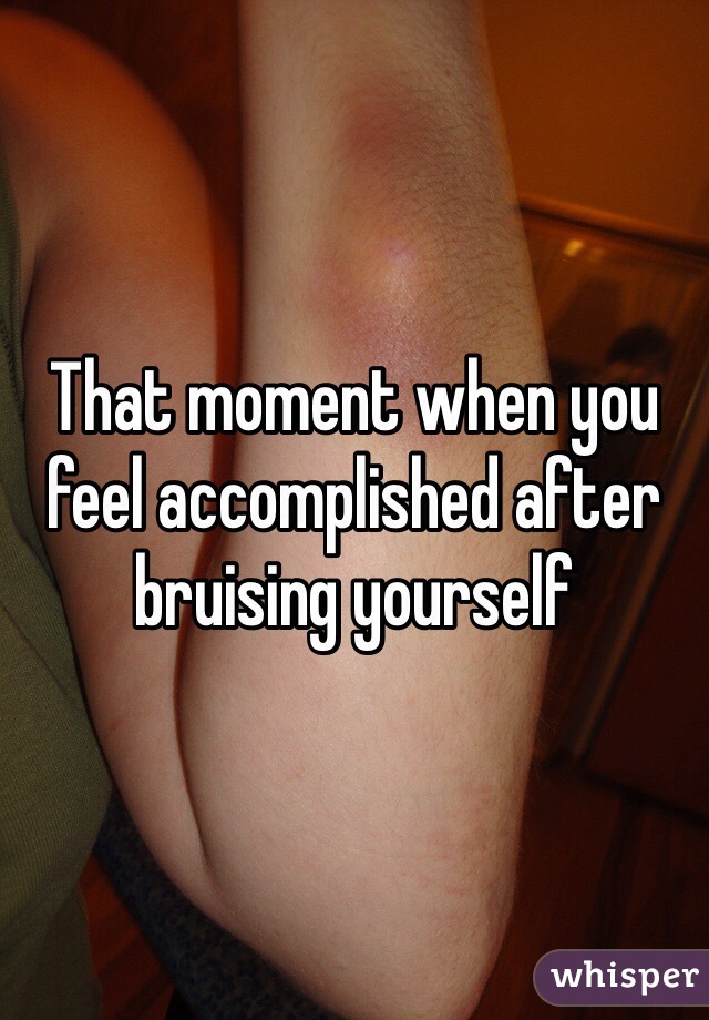 That moment when you feel accomplished after bruising yourself  