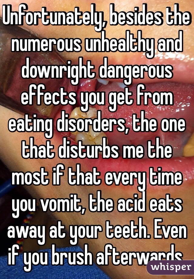 Unfortunately, besides the numerous unhealthy and downright dangerous effects you get from eating disorders, the one that disturbs me the most if that every time you vomit, the acid eats away at your teeth. Even if you brush afterwards. 
