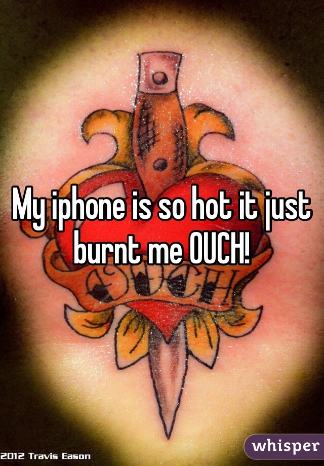 My iphone is so hot it just burnt me OUCH!