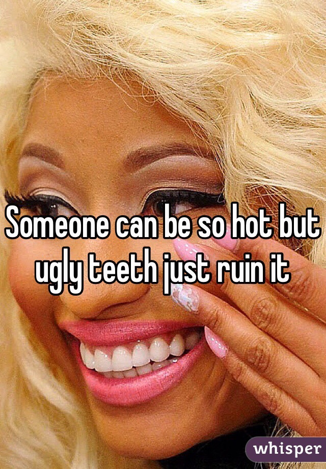 Someone can be so hot but ugly teeth just ruin it 