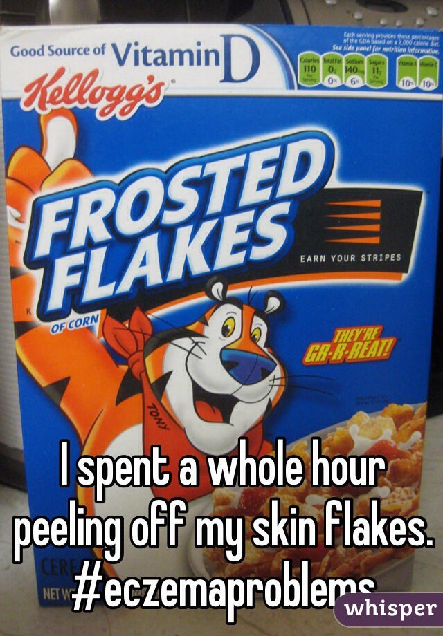 I spent a whole hour peeling off my skin flakes. #eczemaproblems
