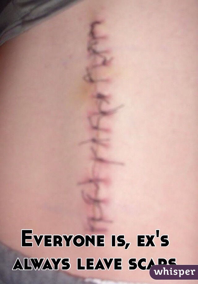 Everyone is, ex's always leave scars