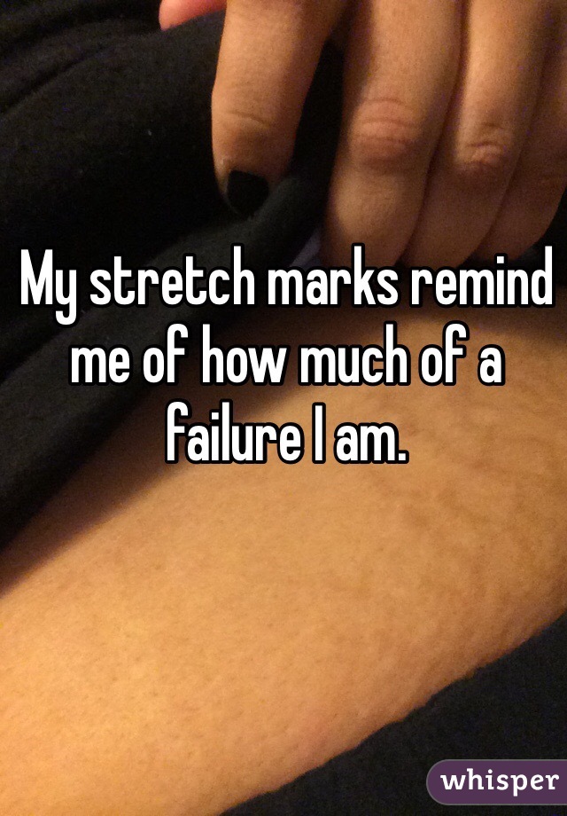 My stretch marks remind me of how much of a failure I am. 