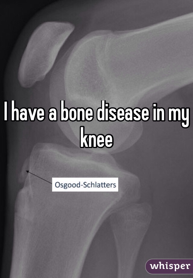 I have a bone disease in my knee
