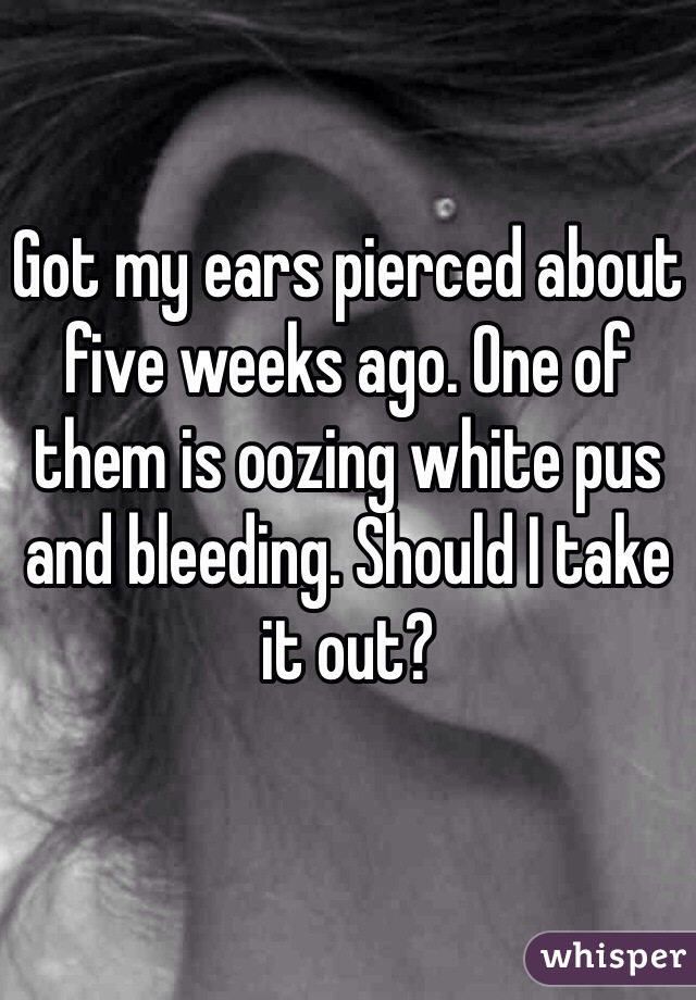 Got my ears pierced about five weeks ago. One of them is oozing white pus and bleeding. Should I take it out?