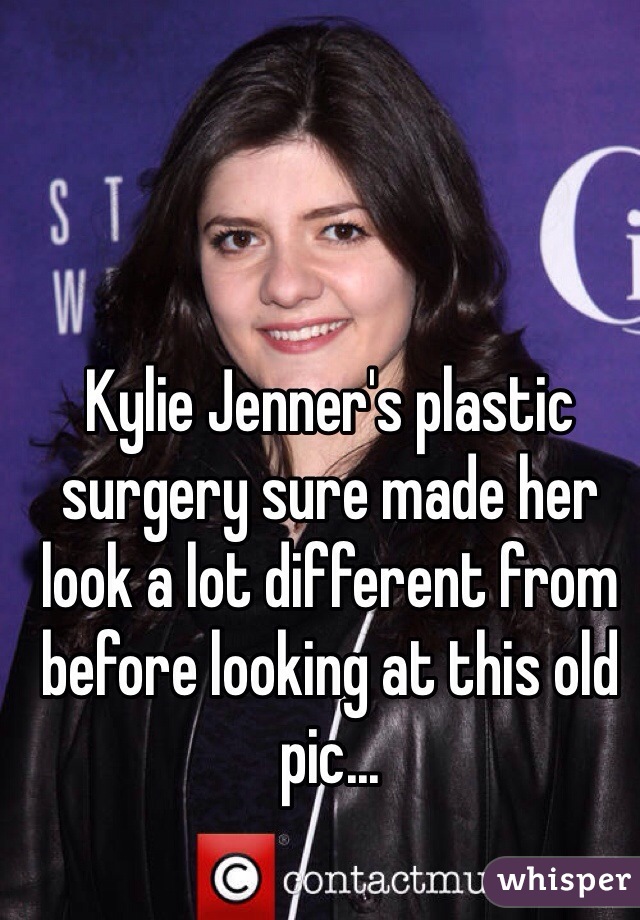 Kylie Jenner's plastic surgery sure made her look a lot different from before looking at this old pic...