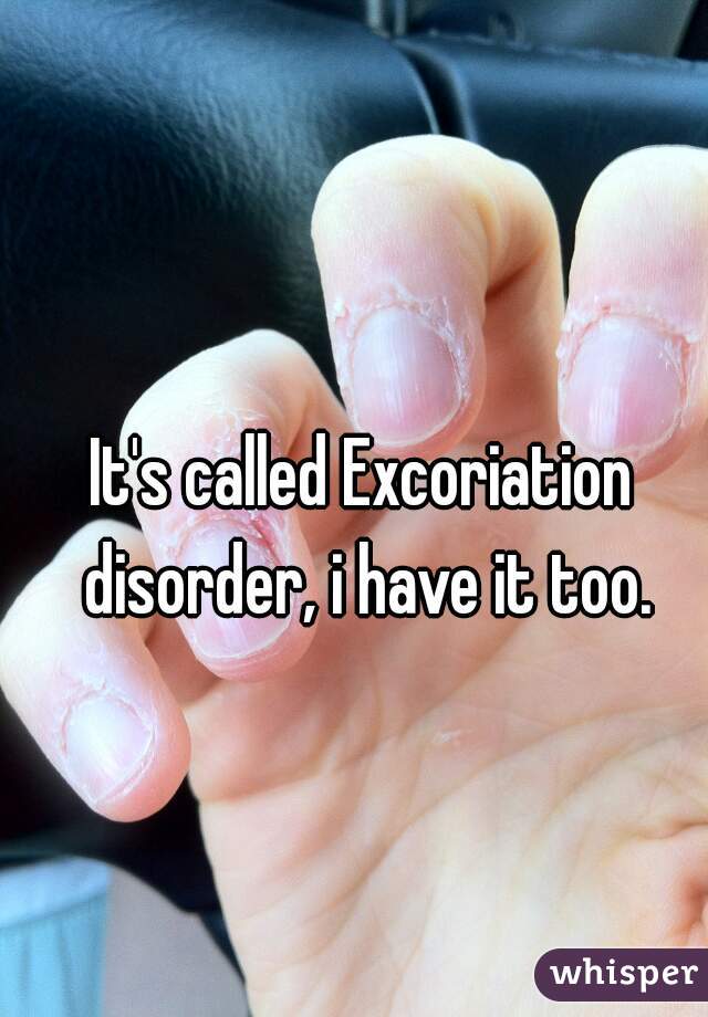 It's called Excoriation disorder, i have it too.