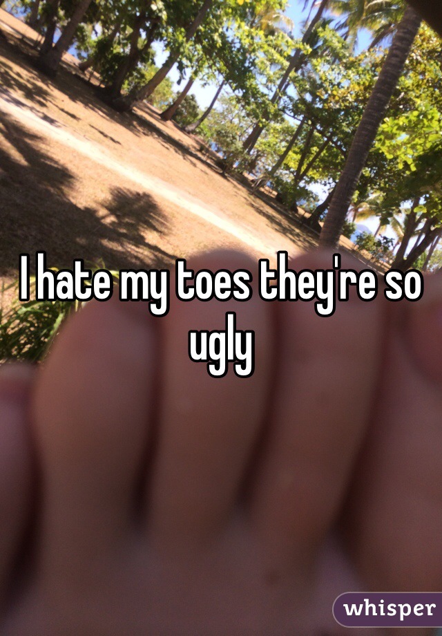 I hate my toes they're so ugly