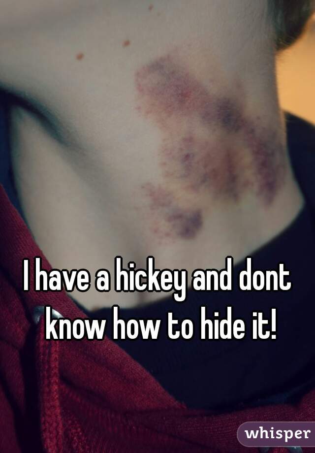 I have a hickey and dont know how to hide it!