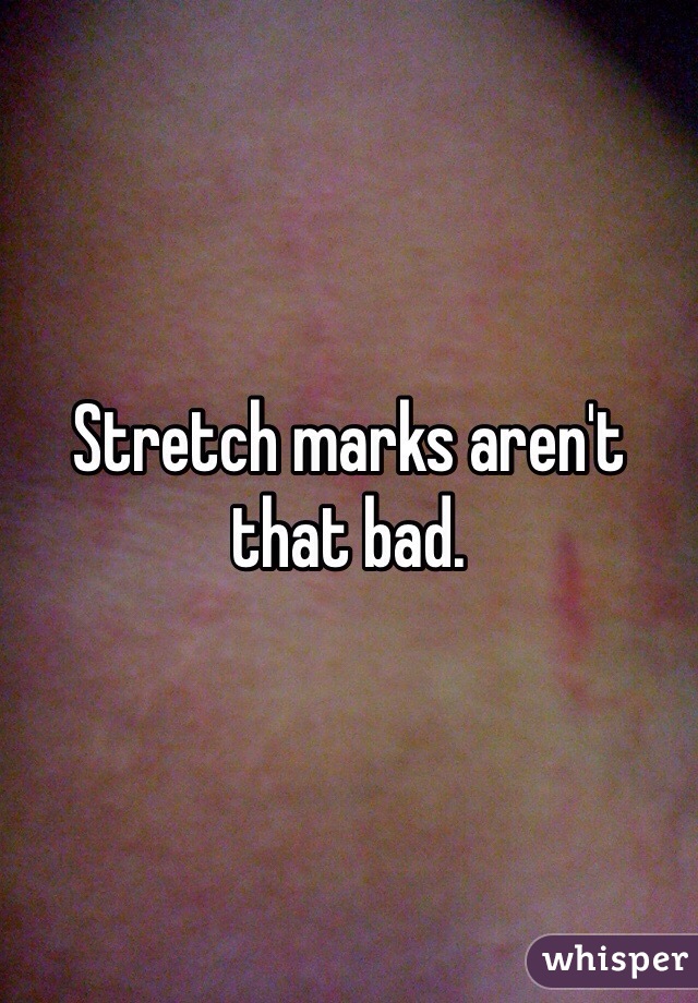 Stretch marks aren't that bad. 